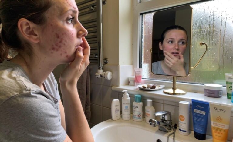 Cardiff's Top Skincare Challenges: Expert Solutions